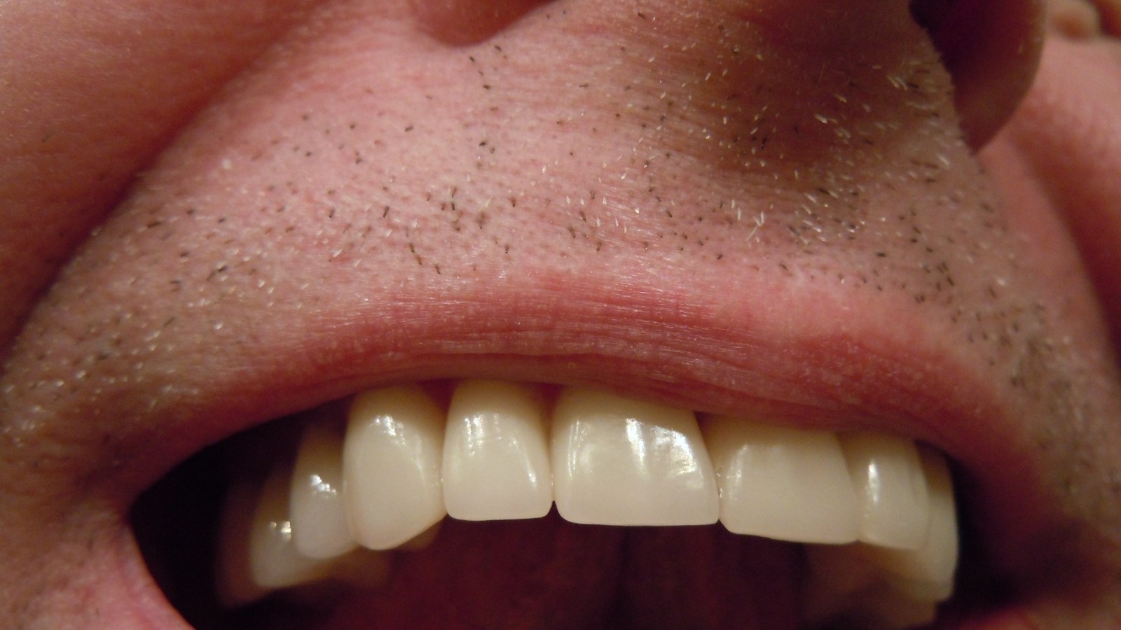 Jak dbano o zęby, gdy nie było past ani szczoteczek?